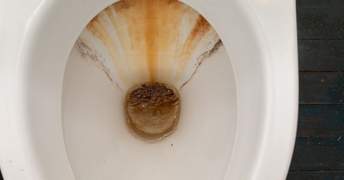 Heavy deposits under toilet rim
